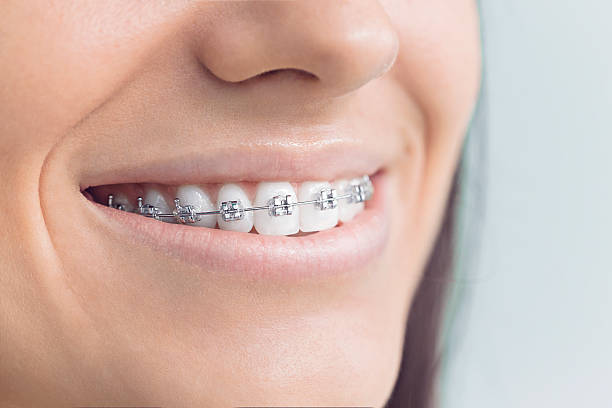 Best Dental Fillings (Composite and Amalgam)  in Argos, IN